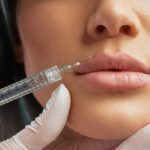Botox pier z vás nemusí urobiť kačicu. Zájdite ale k profesionálom